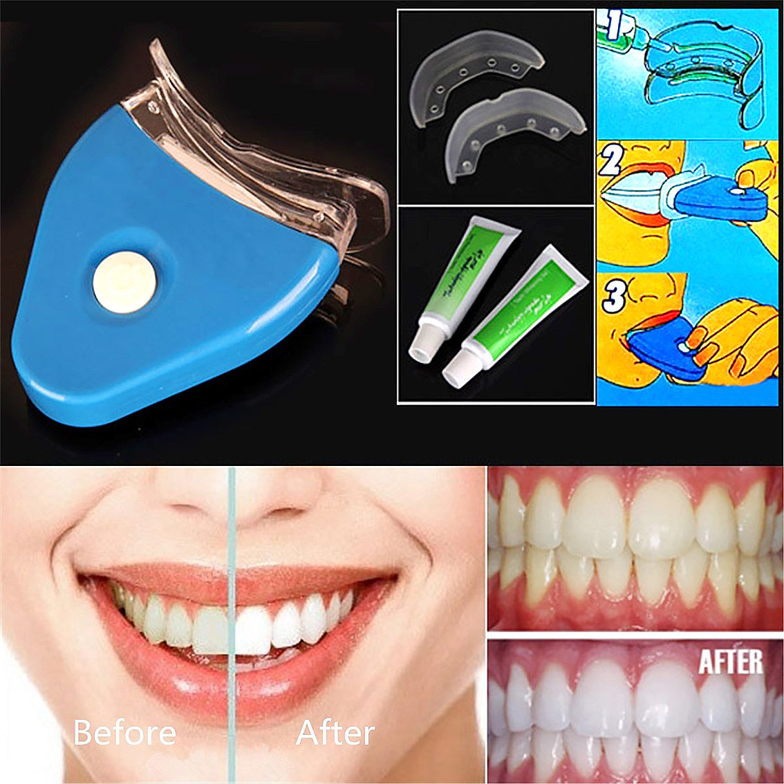 Oral Gel Teeth Tooth Whitening Whitener Dental Bleaching LED - Rokkaku 18 online shop